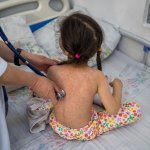 Лекари, отчели фиктивни ваксинации срещу морбили, може да плащат лечението на болните деца